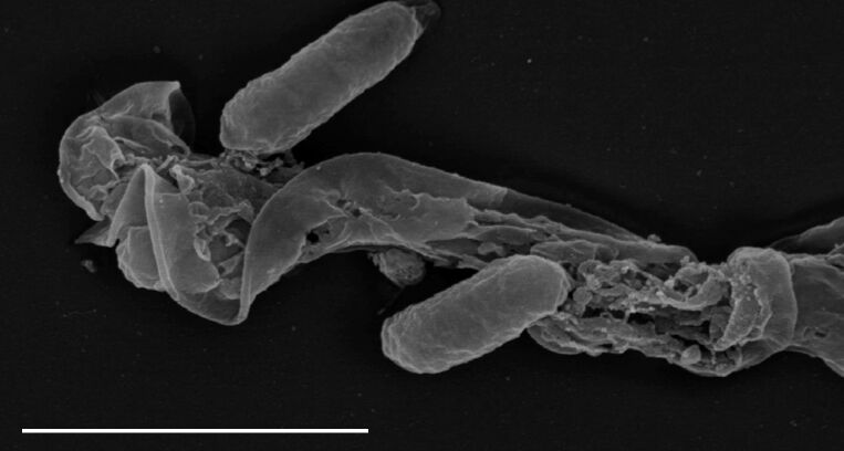 Denne sædcellen stammer fra en bokfink-hann som har vært uheldig med mikrobiomet i sædvæsken.